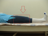 Кровать после операции на тазобедренном. Кровать для реабилитации после операции тазобедренного сустава. Позы для сна после эндопротезирования тазобедренного сустава. Шрам после эндопротезирования тазобедренного.