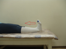 Реабилитация после протезирование коленного сустава thumbnail